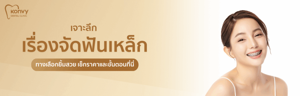 จัดฟันเหล็กคืออะไร