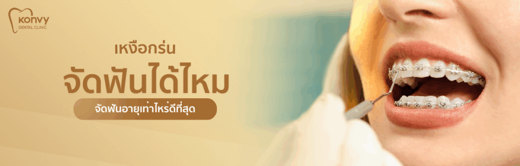 เหงือกร่นจัดฟันได้ไหม
