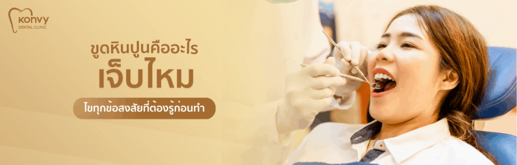 ขูดหินปูนคืออะไร เจ็บไหม