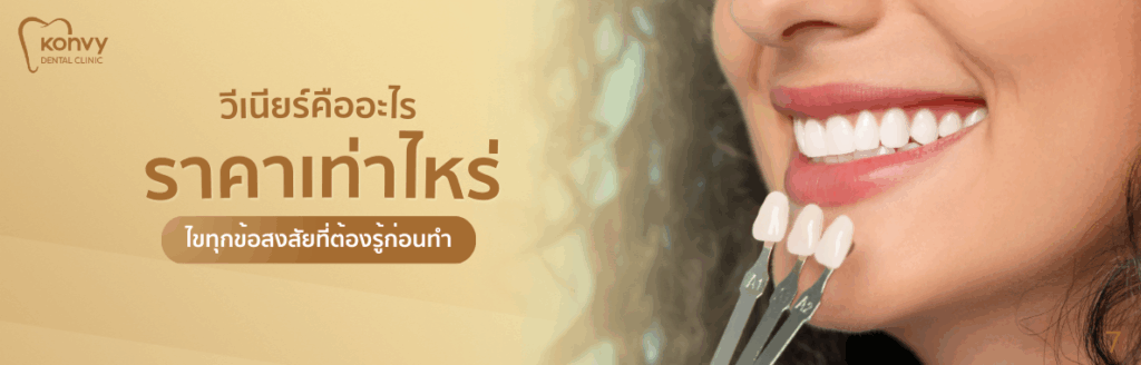 วีเนียร์คืออะไร ราคาเท่าไหร่