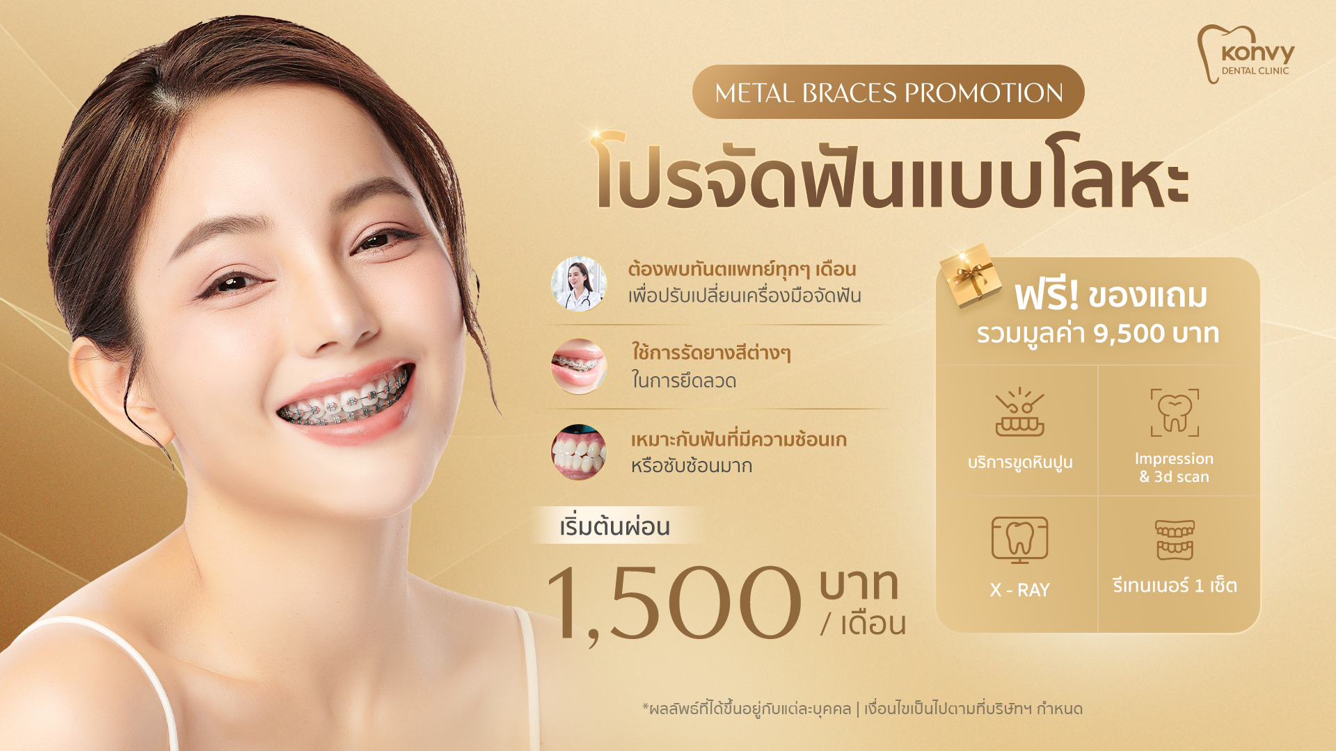 Promotion จัดฟันเหล็ก