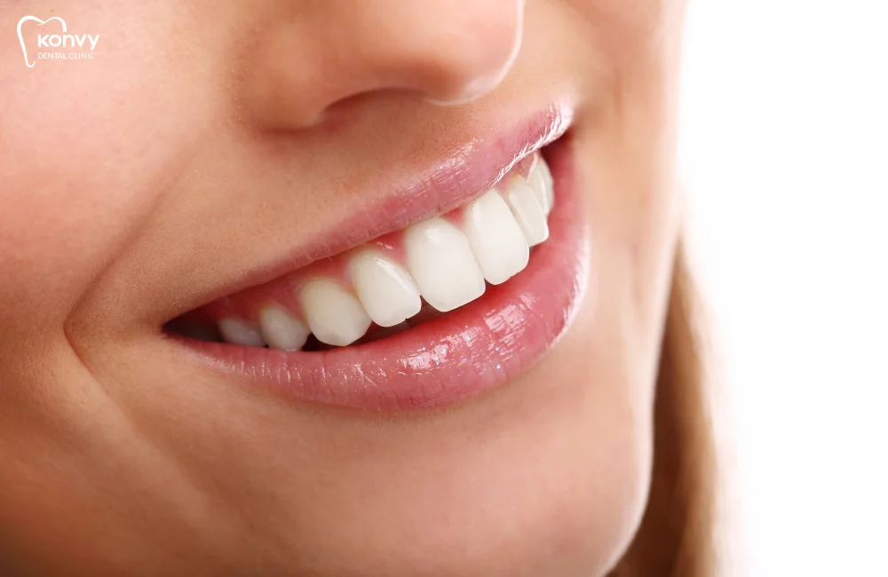 เจาะลึกวิธีฟอกสีฟันโดยทันตแพทย์