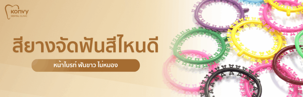 สียางจัดฟัน เลือกยังไงให้รอด