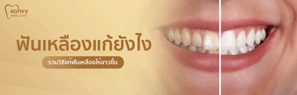 วิธีแก้ฟันเหลืองให้ขาว ปลอดภัย