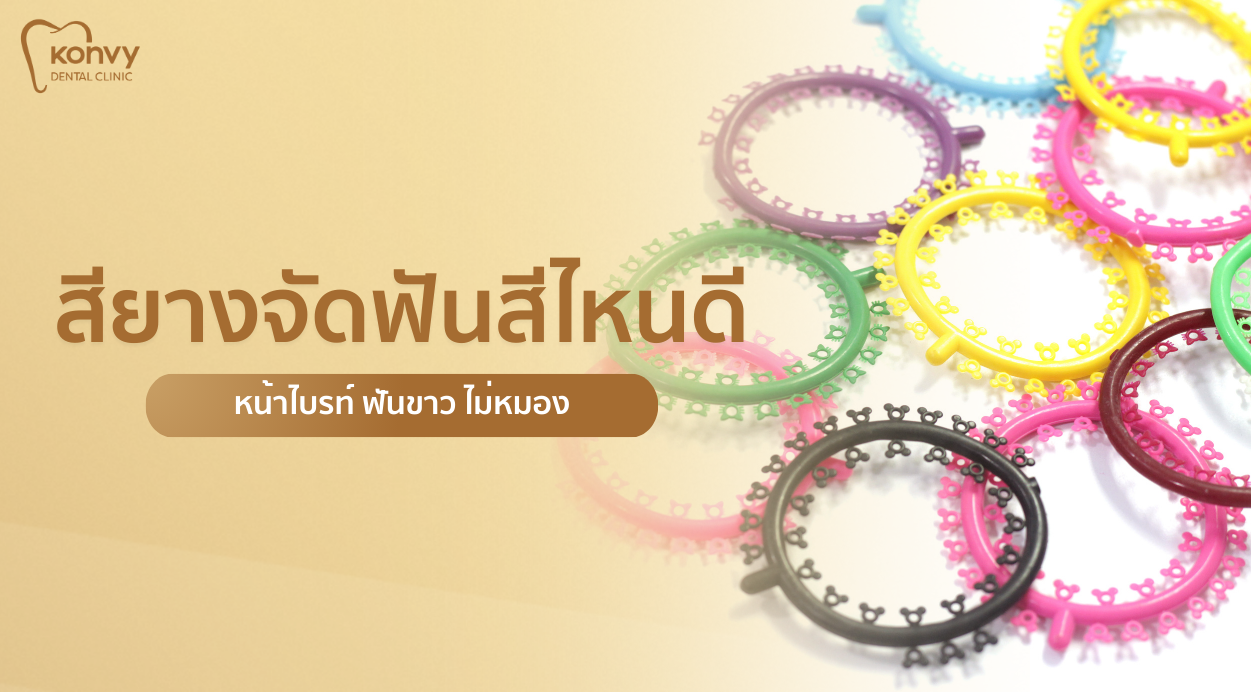 สียางจัดฟัน เลือกยังไงให้รอด? รวมสีช่วยขับผิว ฟันขาว