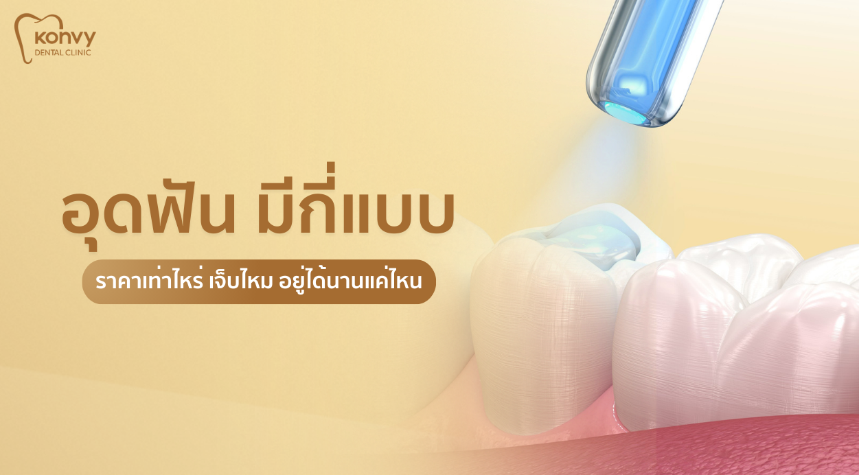 อุดฟันเจ็บไหม