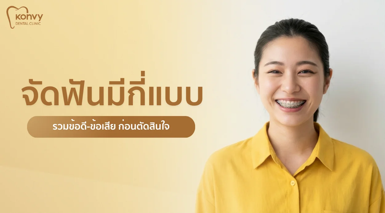 จัดฟันมีกี่แบบ เลือกแบบไหนดี