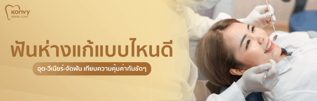 ฟันห่างแก้แบบไหนดี