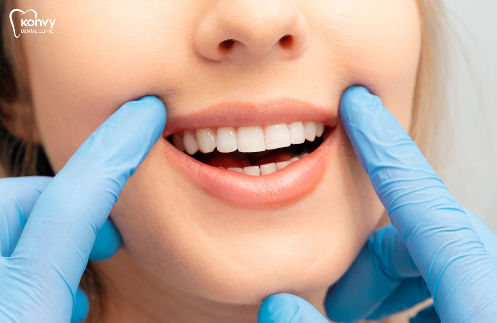 คำถามที่พบบ่อยเกี่ยวกับฟันห่าง