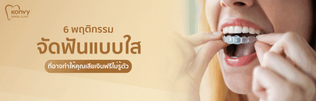 พฤติกรรมจัดฟันแบบใส ข้อดี ข้อเสีย