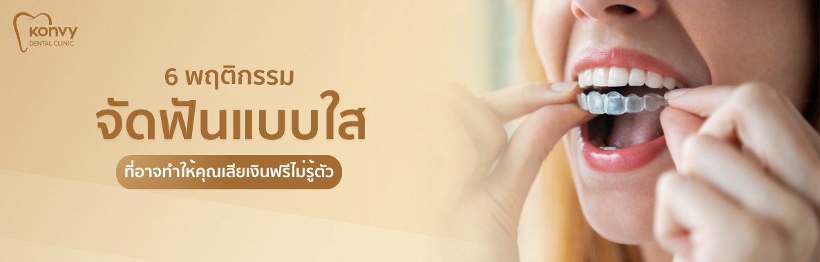 6 พฤติกรรมจัดฟันใส ที่อาจทำให้คุณเสียเงินฟรีไม่รู้ตัว