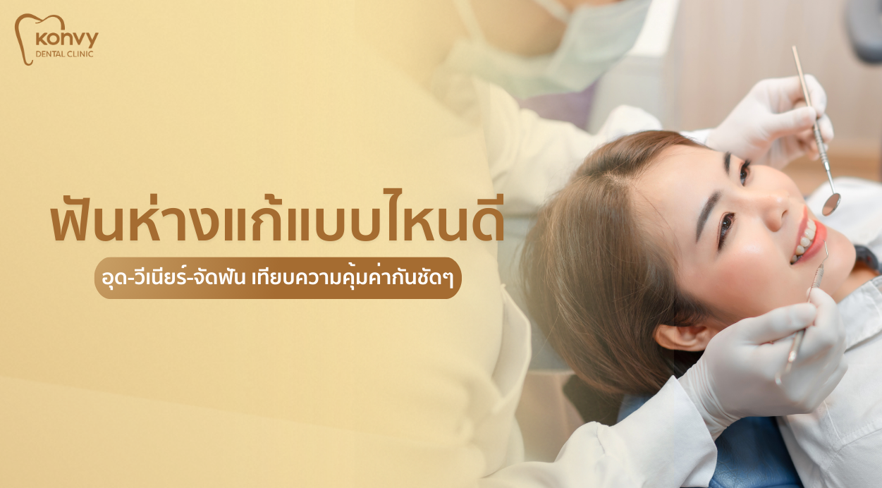 ฟันห่างแก้แบบไหนดี อุด-วีเนียร์-จัดฟัน เทียบความคุ้มค่ากันชัดๆ