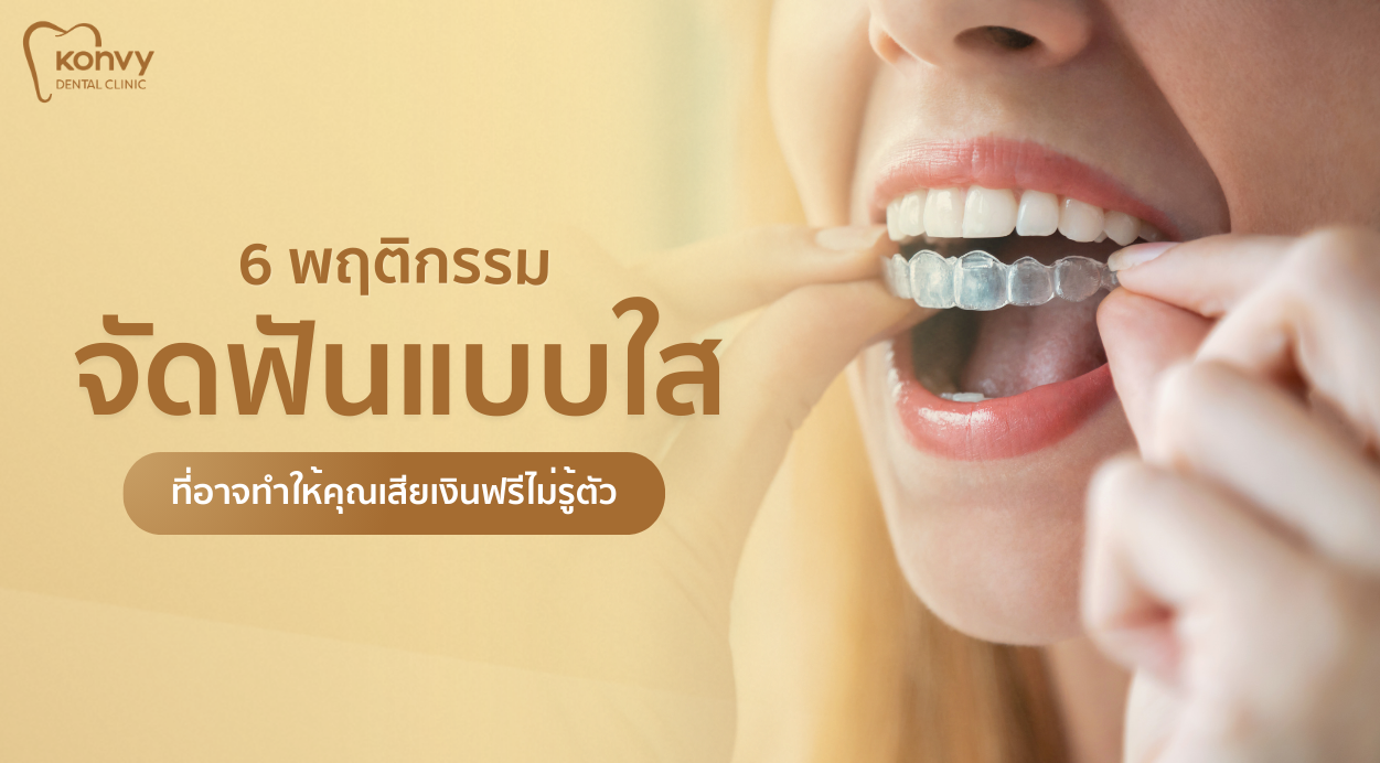 พฤติกรรมจัดฟันแบบใส ข้อดี ข้อเสีย